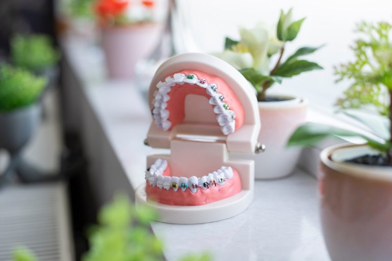Orthodontics and Braces